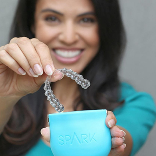 What are Spark aligners?