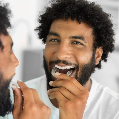 How do Spark aligners work?